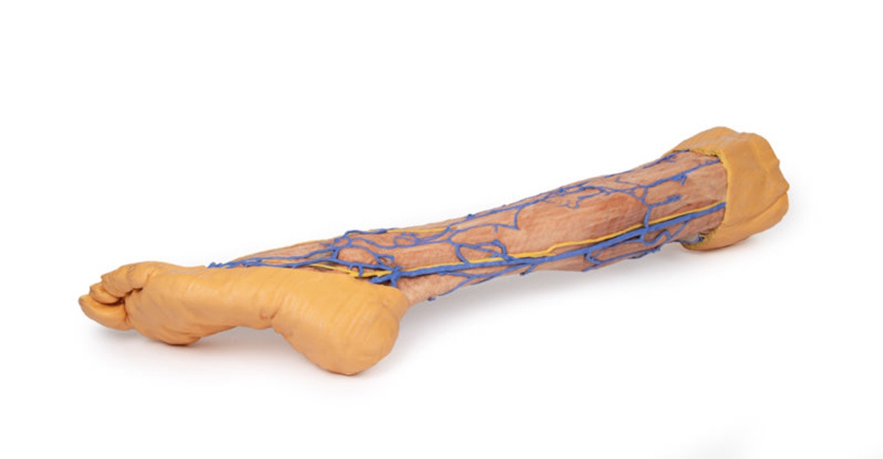3D Printed Lower Limb Superficial Veins