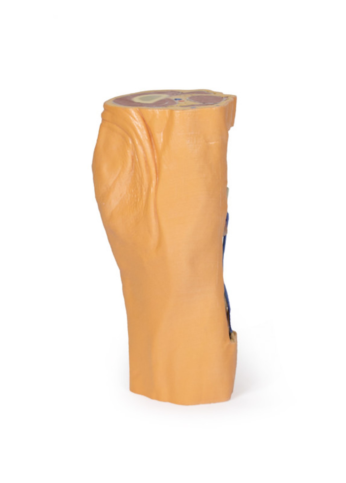 3D Printed Popliteal Fossa Distal Thigh and Proximal Leg