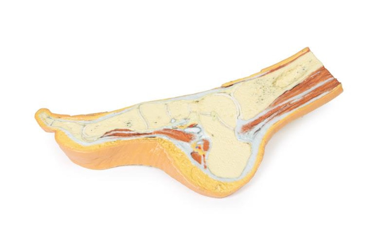 3D printed foot. Full view. Exposed bone and soft tissue.