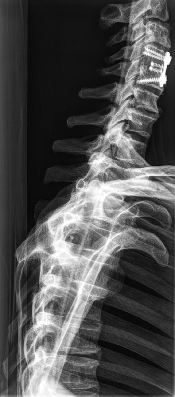 Full Body X-Ray Phantom With Real Human Skeleton Bones