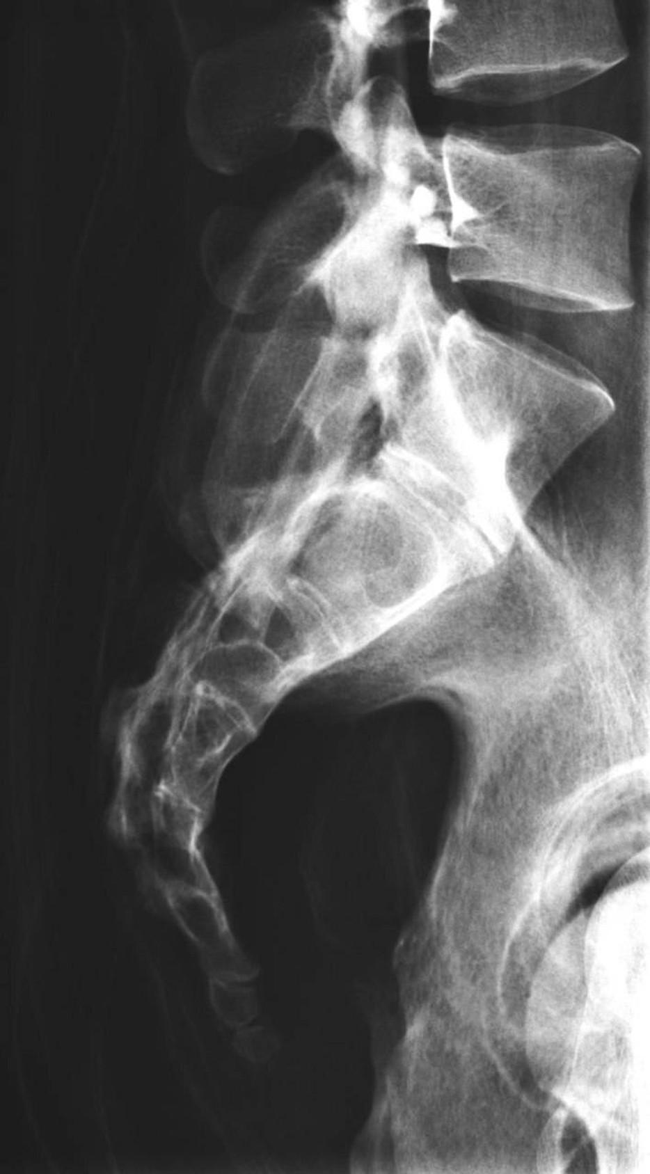 Full Body X-Ray Phantom With Real Human Skeleton Bones