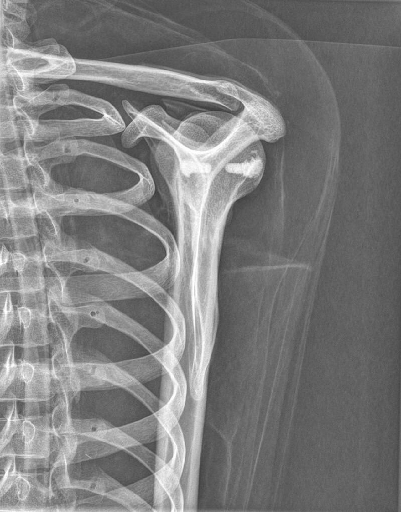 Full Body X-Ray Phantom With Real Human Skeleton Bones