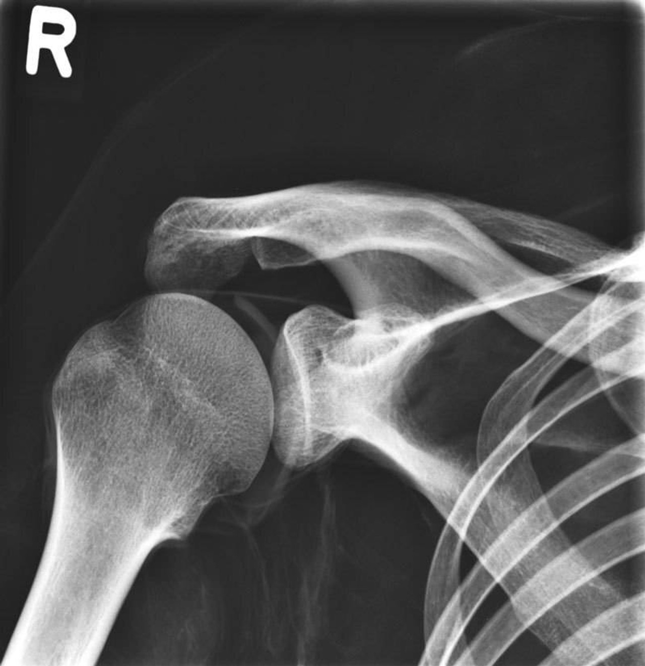Full Body X-Ray Phantom With Real Human Skeleton Bones
