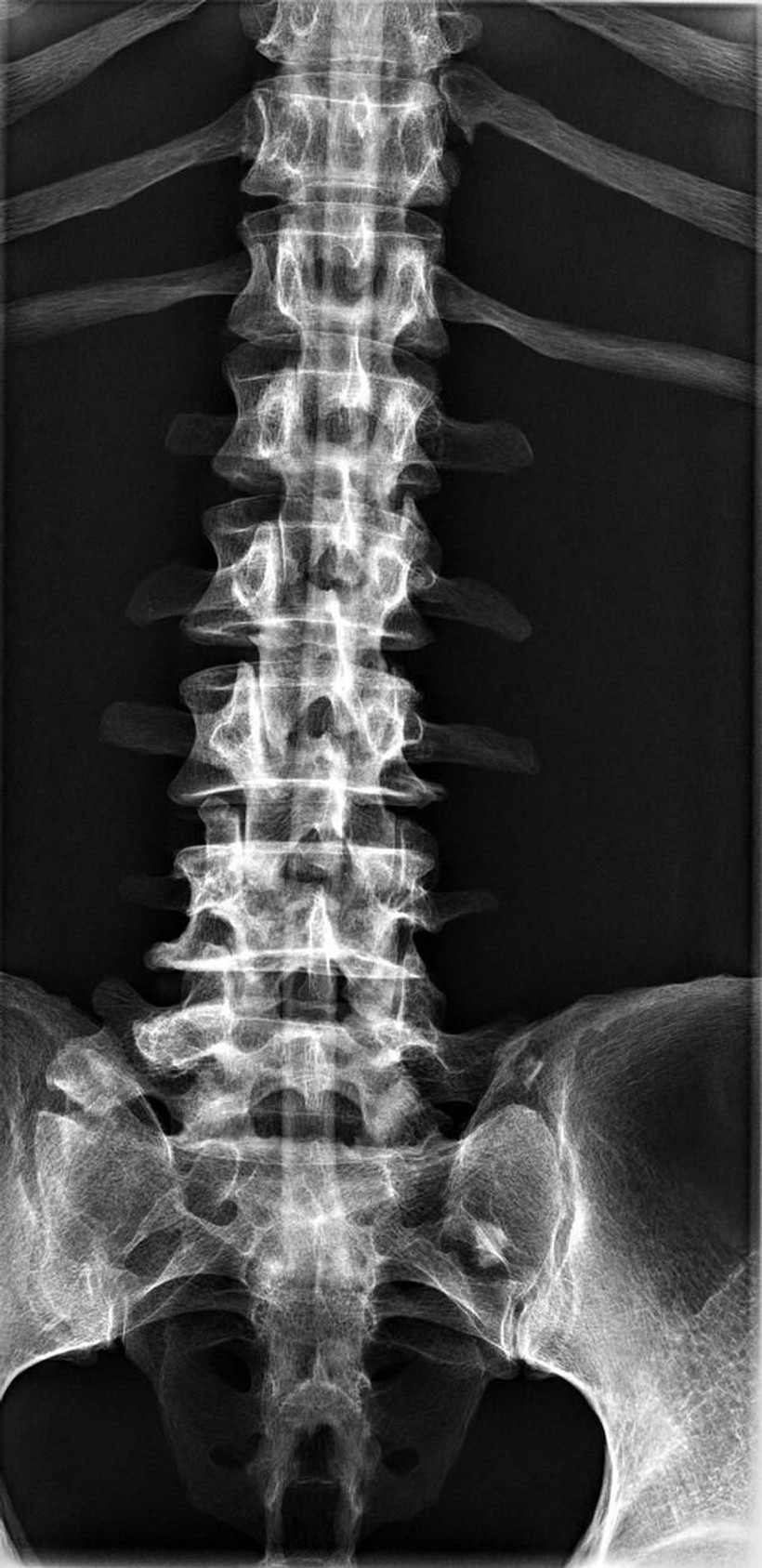 Full Body X-Ray Phantom With Real Human Skeleton Bones