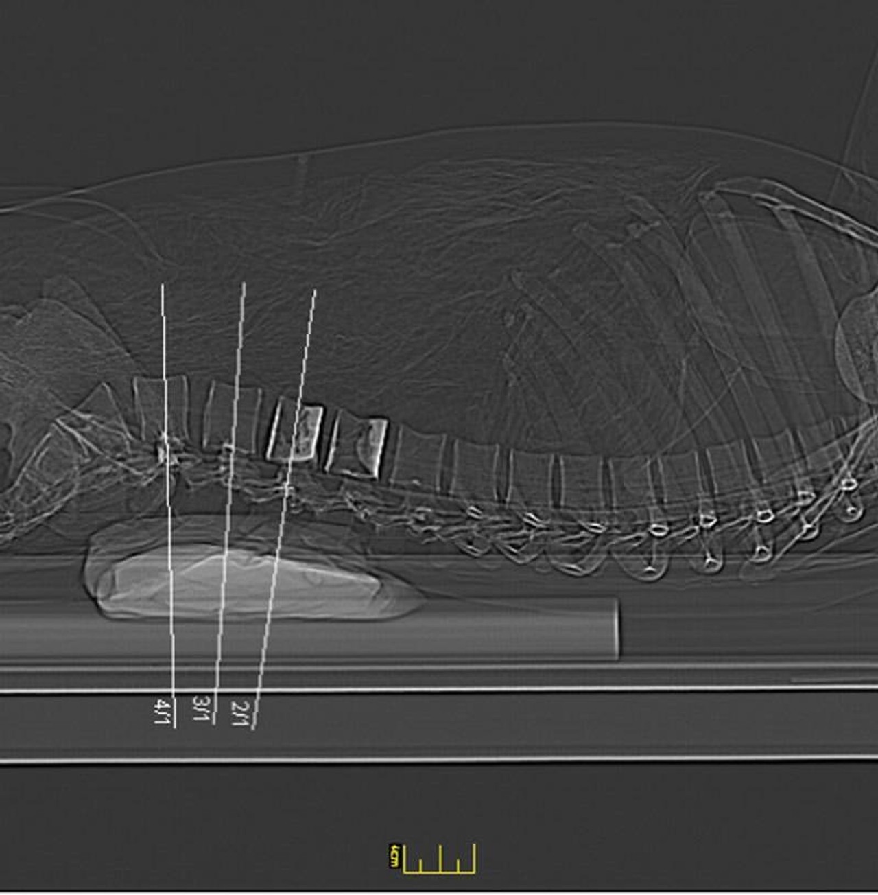 Full Body X-Ray Phantom With Real Human Skeleton Bones