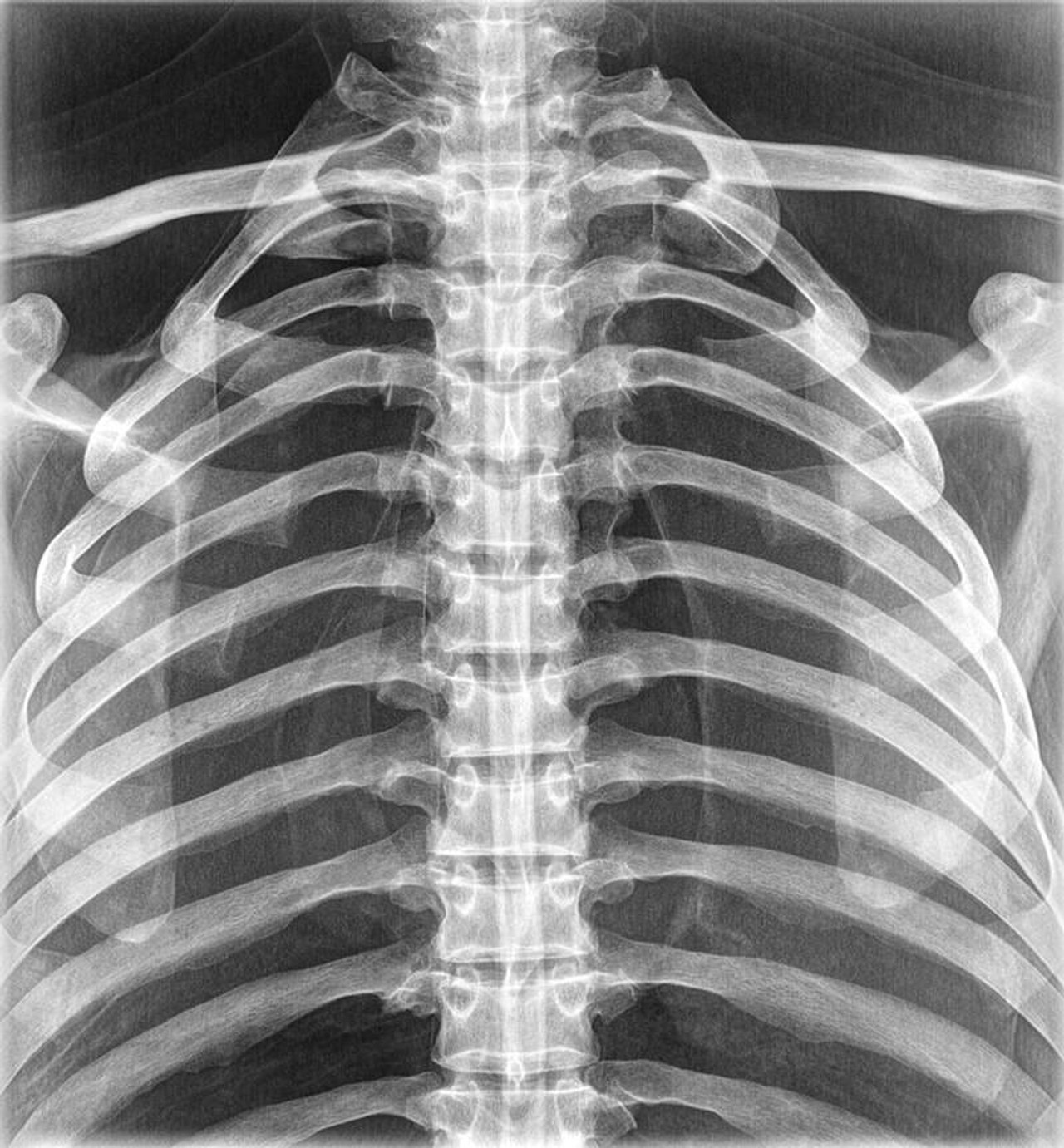 Full Body X-Ray Phantom With Real Human Skeleton Bones