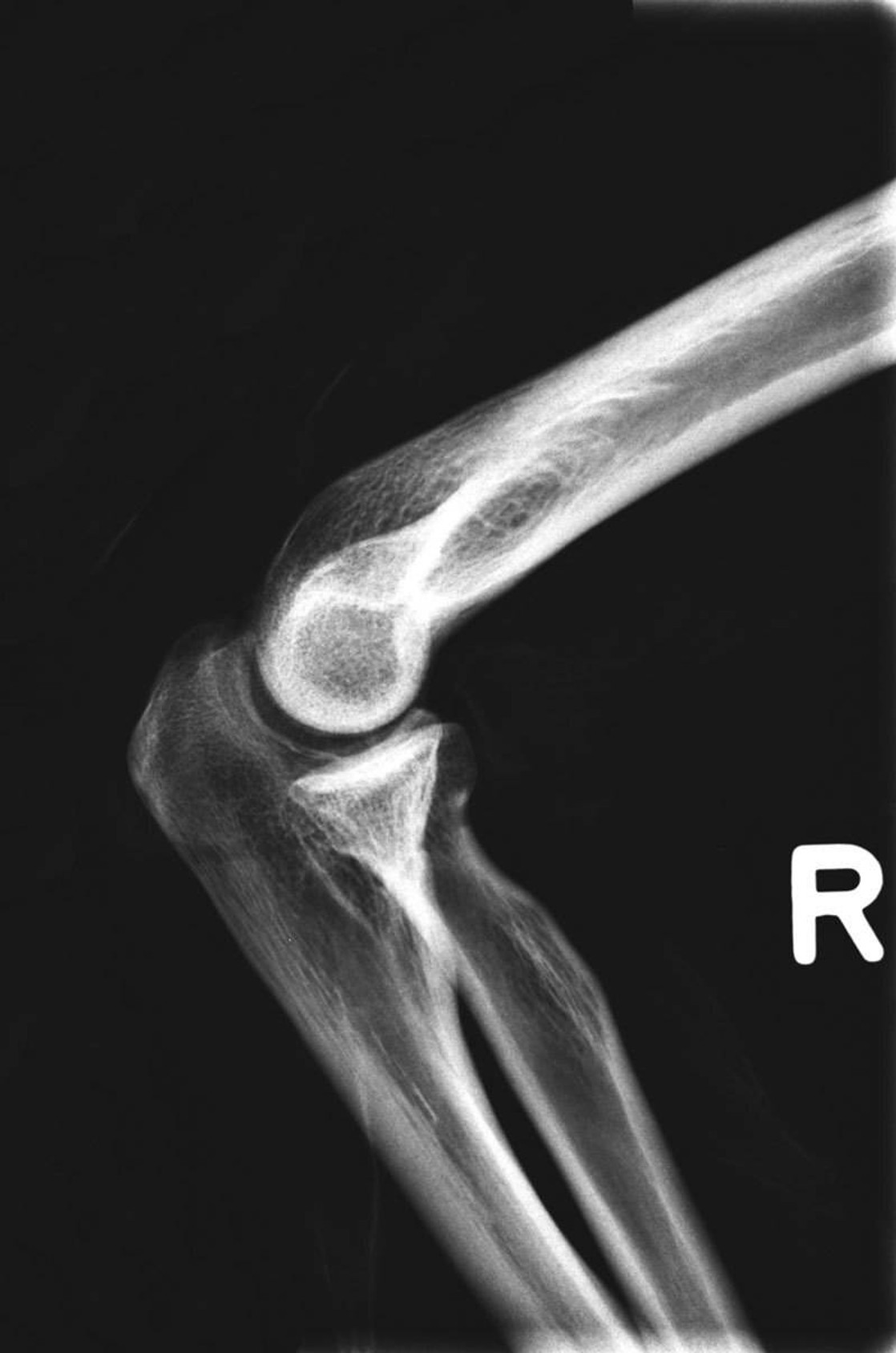 Full Body X-Ray Phantom With Real Human Skeleton Bones
