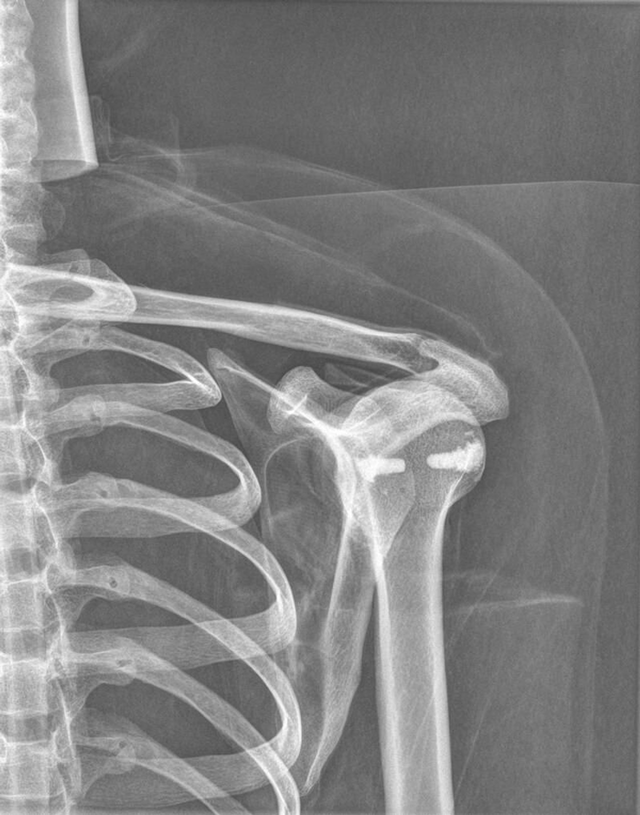 Full Body X-Ray Phantom With Real Human Skeleton Bones