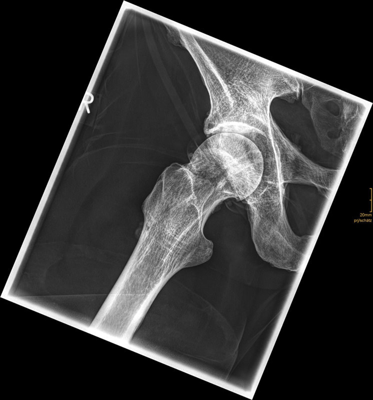 Full Body X-Ray Phantom With Real Human Skeleton Bones