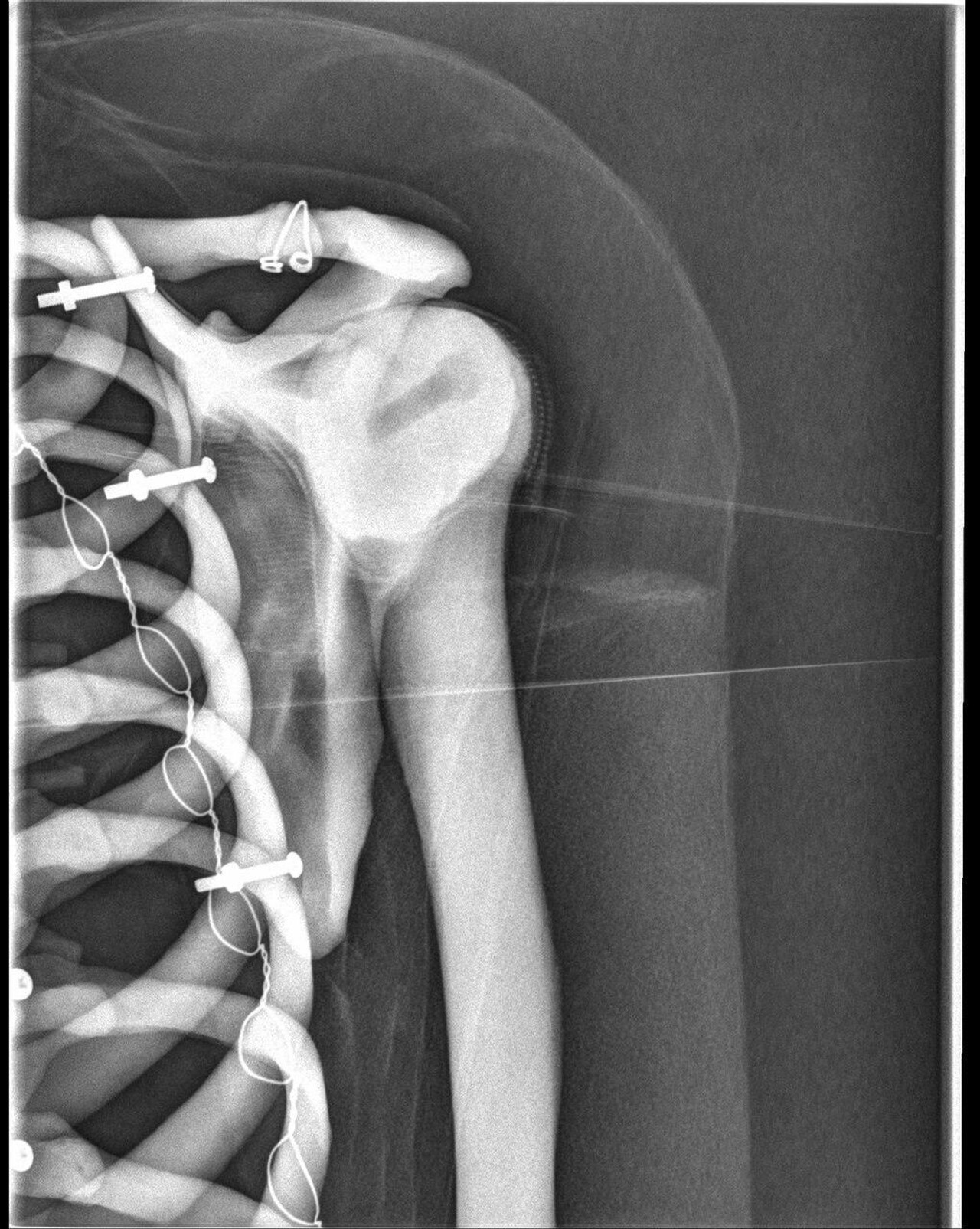 Radiographic Positioning Doll, Plastic Skeleton
