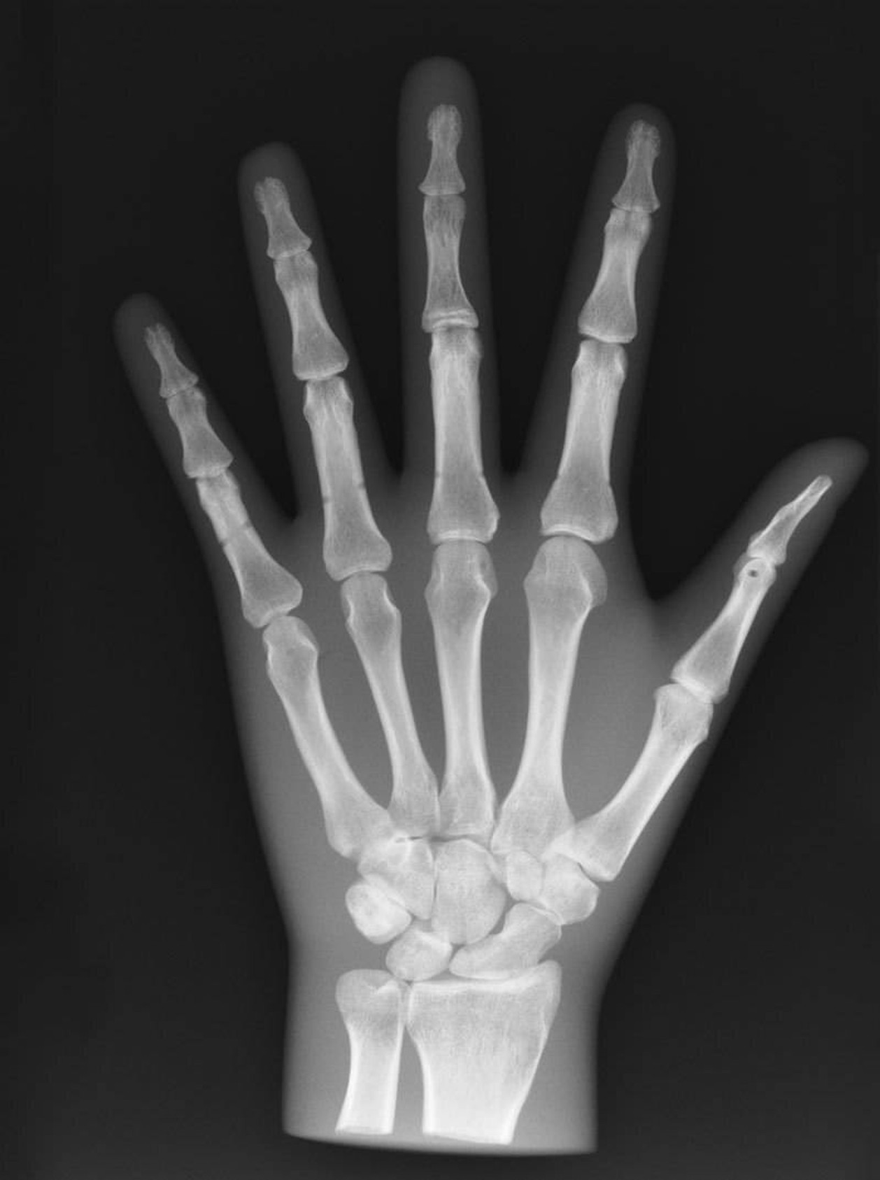 X-Ray Phantom Hand, Transparent