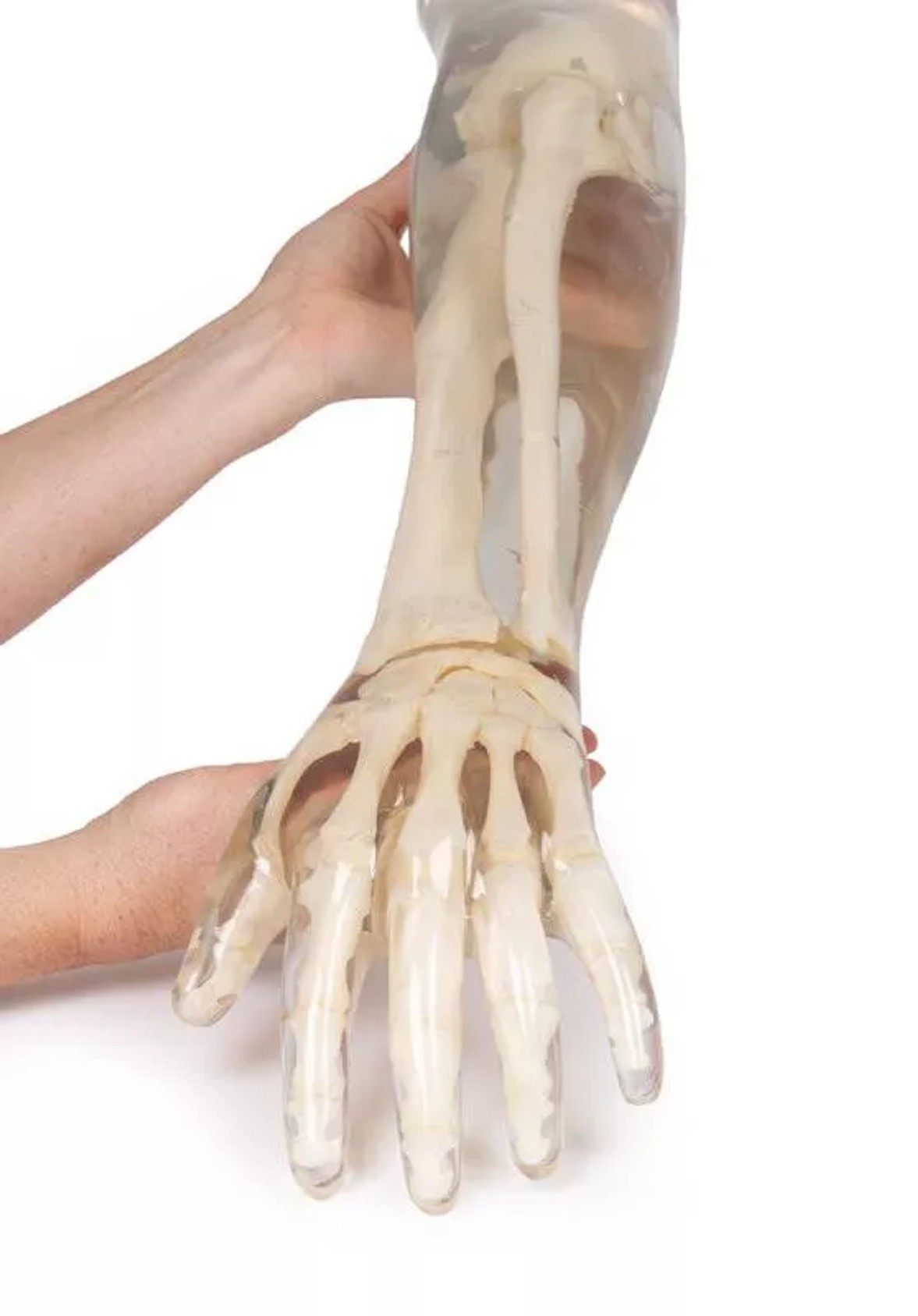 X-Ray Phantom Lower Arm, Transparent