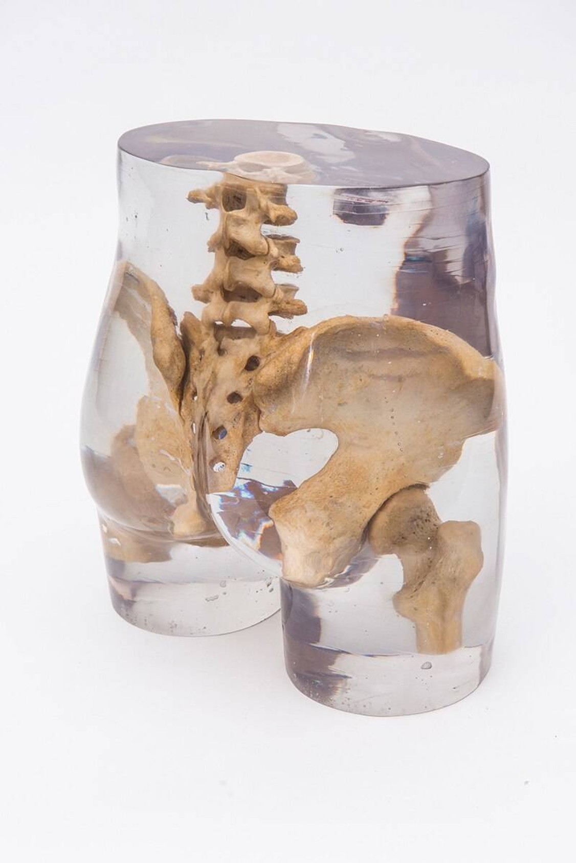 X-Ray Phantom Pelvis, Transparent