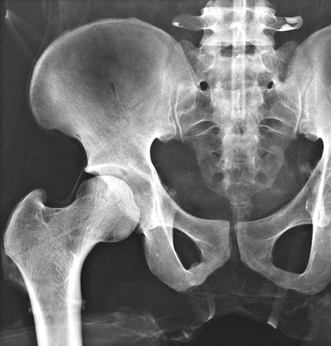 X-Ray Phantom Pelvis, Transparent