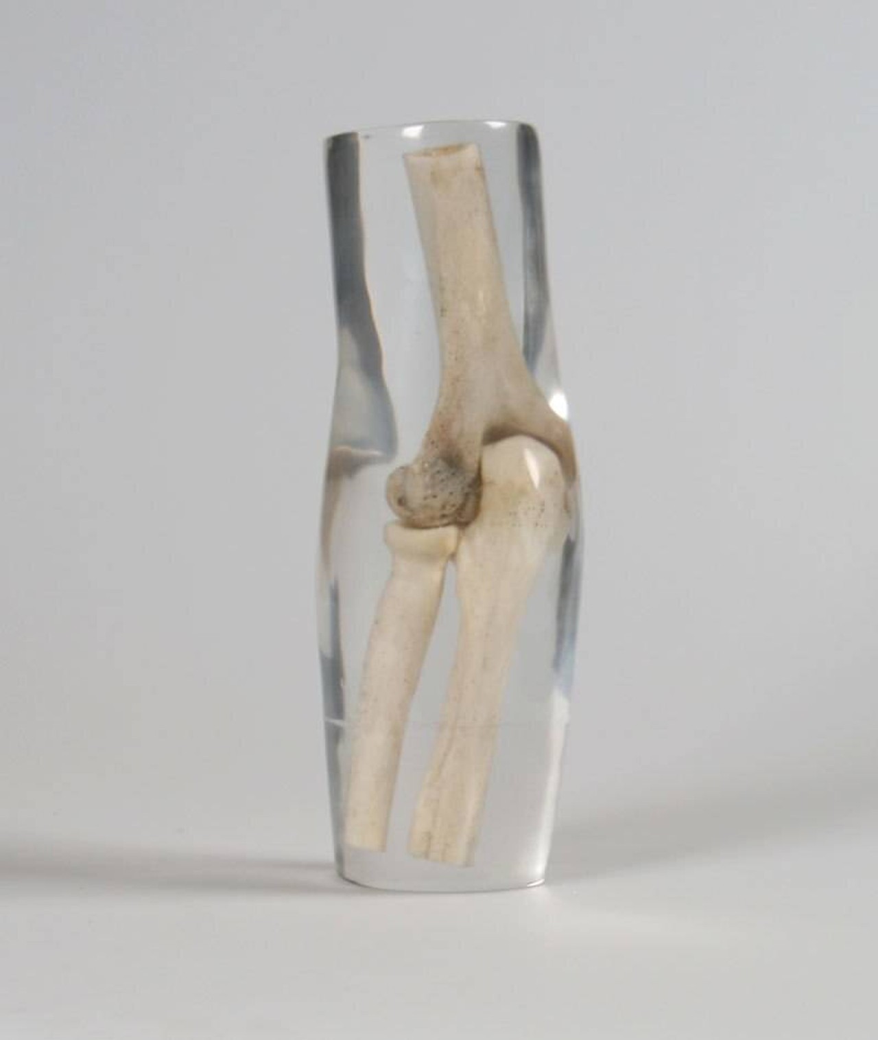 X-Ray Phantom Elbow, Transparent