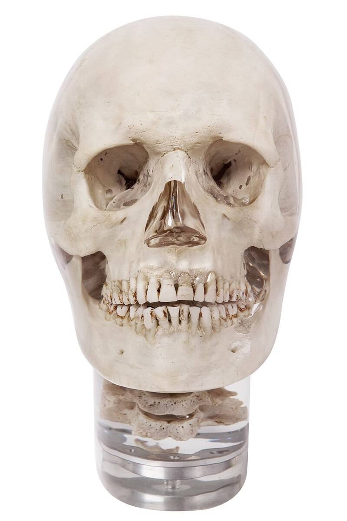 X-Ray Phantom Head With Cervical Vertebrae, Transparent