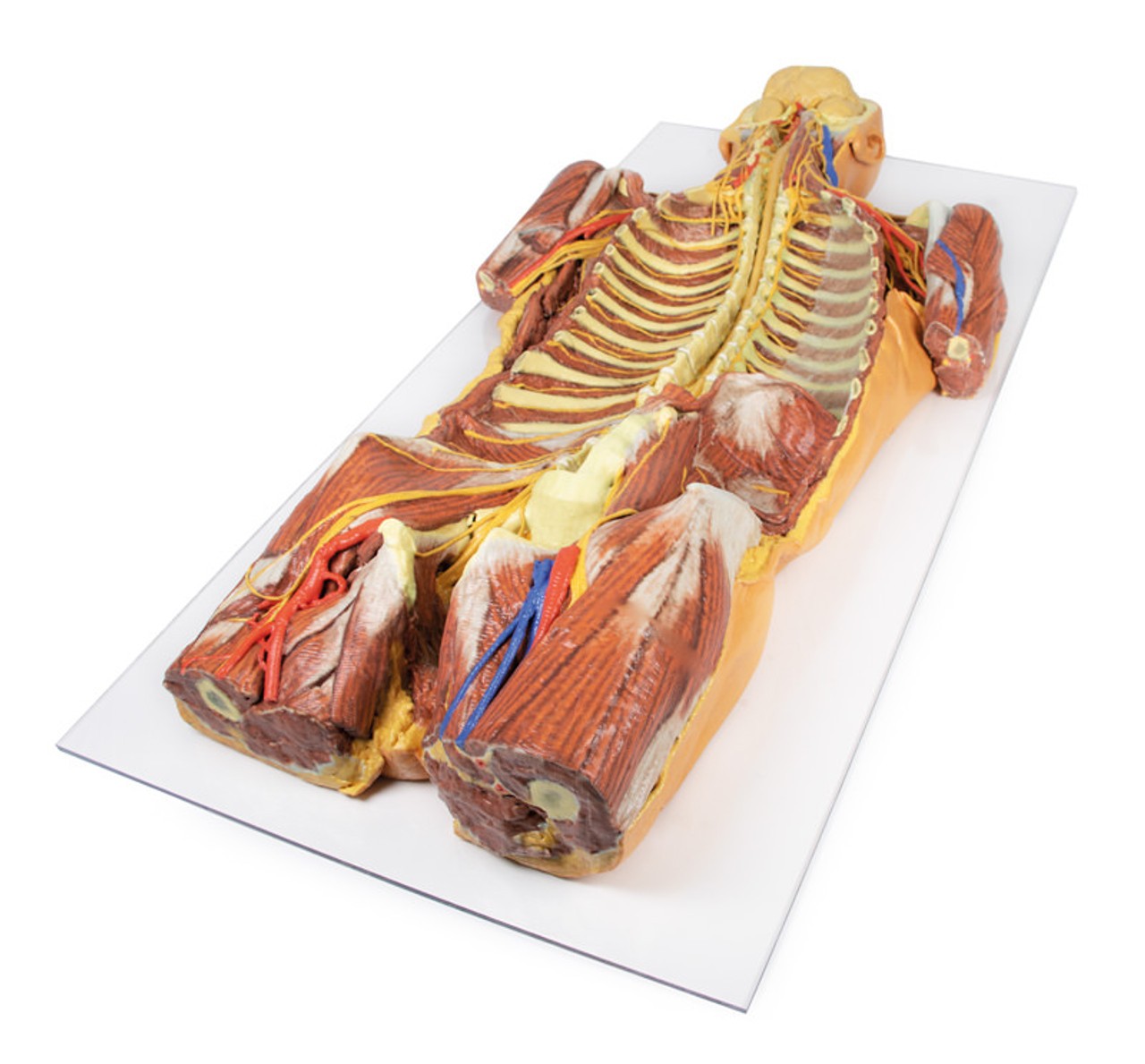 3D Printed Ventral Deep Dissection - Posterior Body Wall