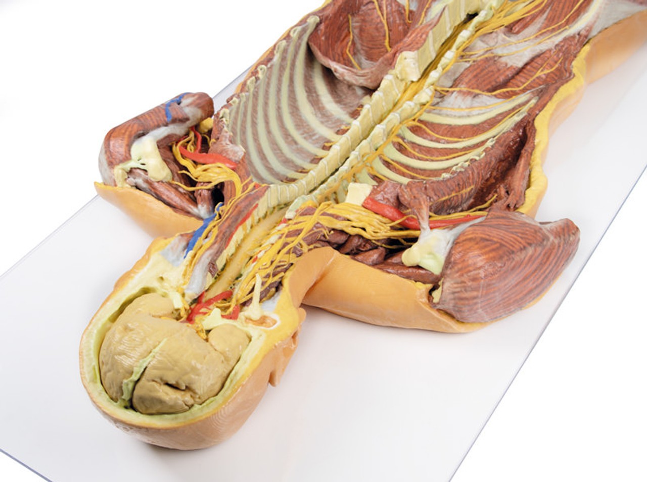 3D Printed Ventral Deep Dissection - Posterior Body Wall