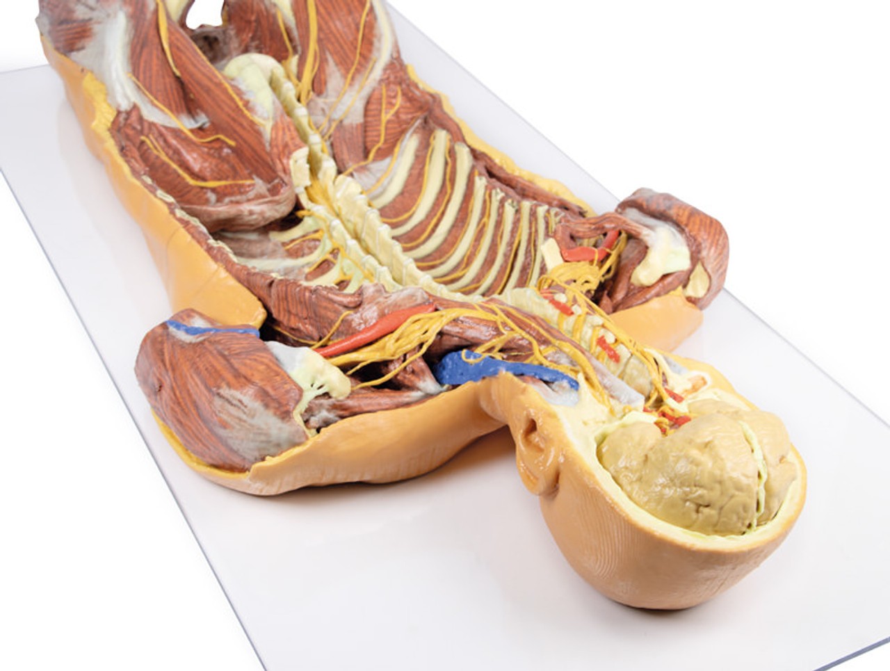 3D Printed Ventral Deep Dissection - Posterior Body Wall