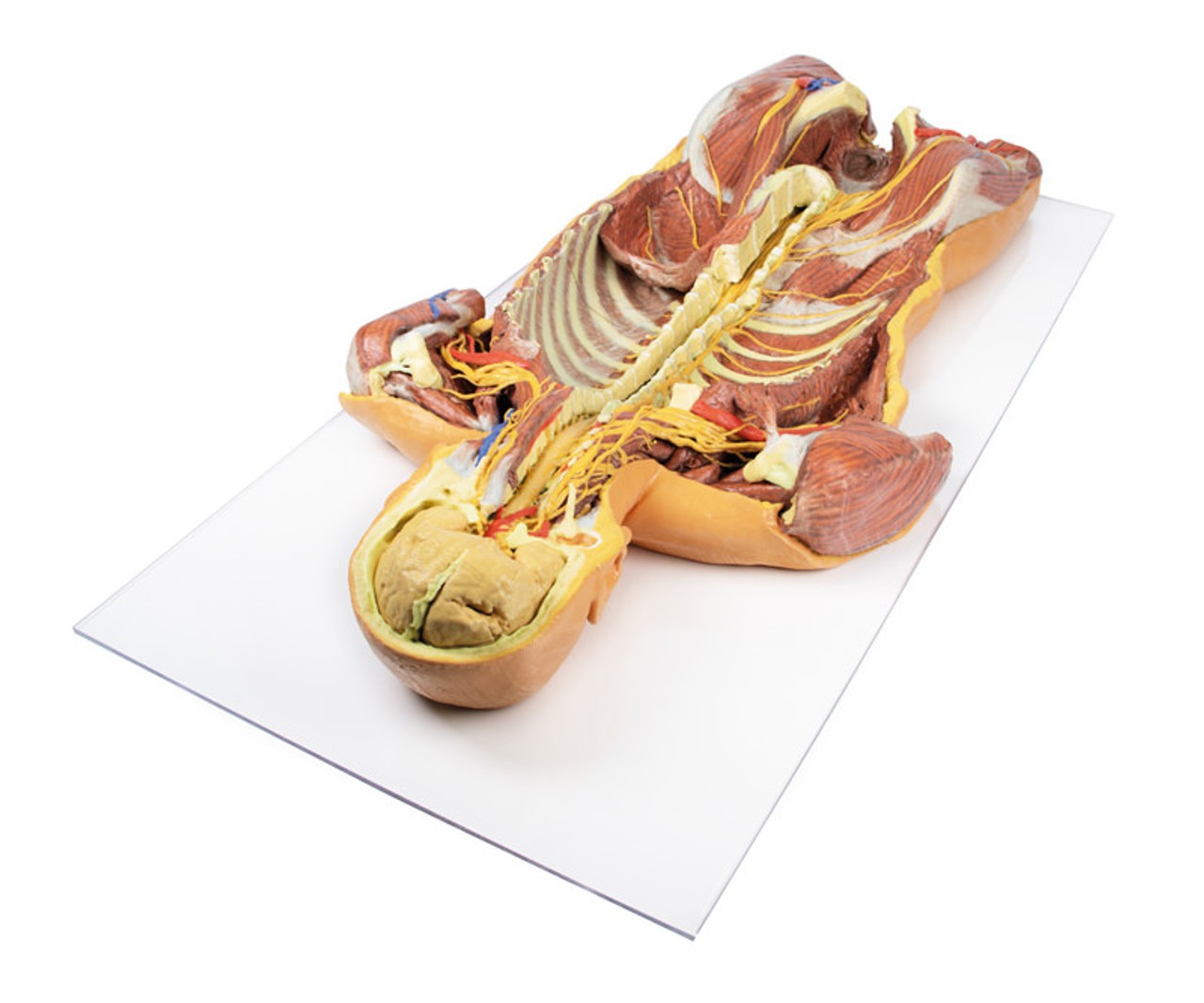 3D Printed Ventral Deep Dissection - Posterior Body Wall