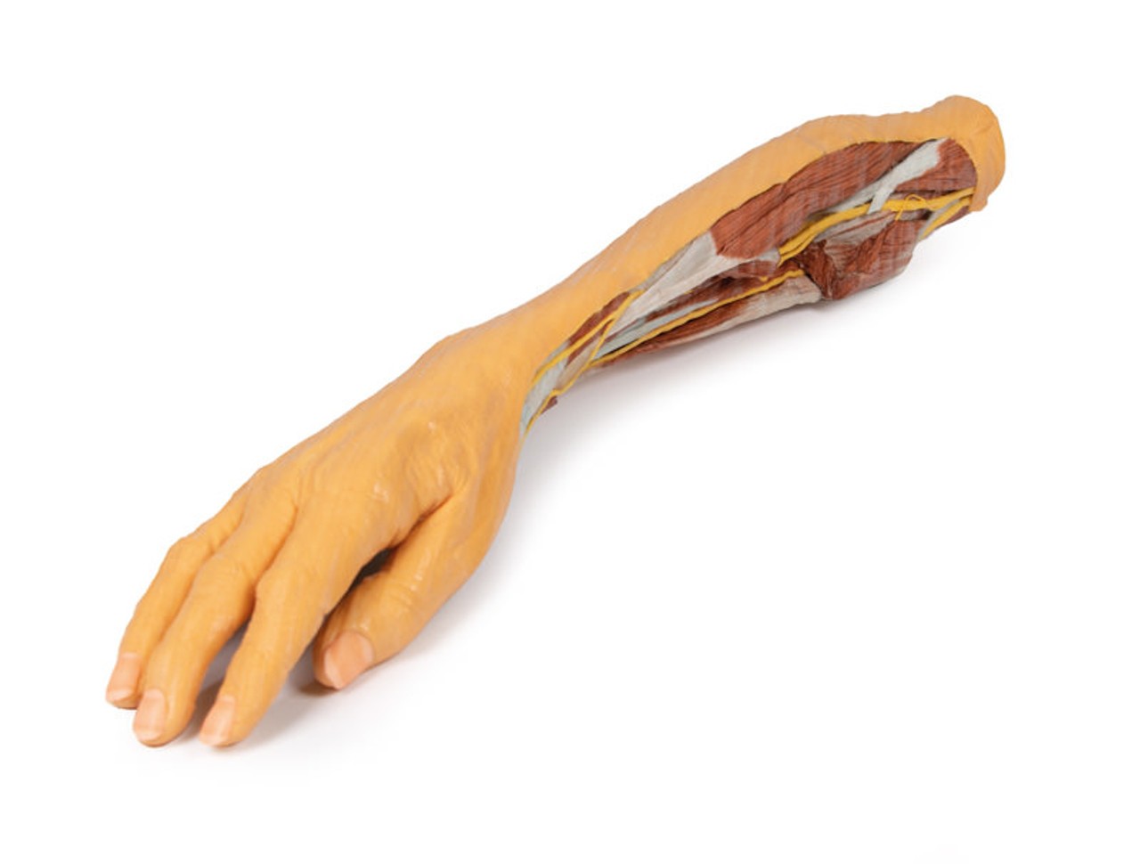 3D printed forearm and hand. Full view.