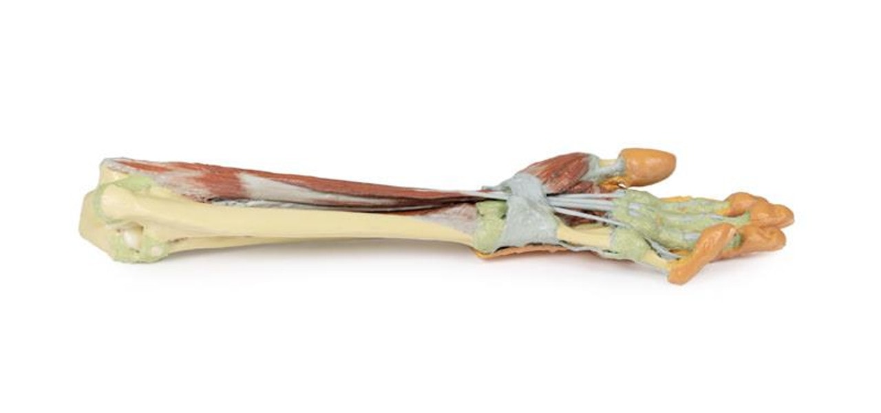 3D printed forearm and hand. Full view. Exposed muscle and bone. Bottom angle.