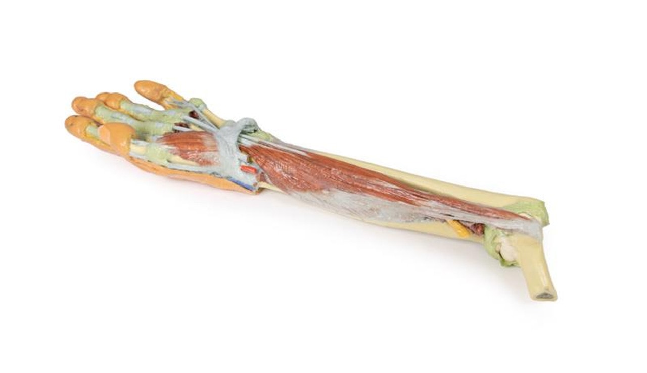 3D printed forearm and hand. Full view. Exposed muscle and bone. Bottom angle.