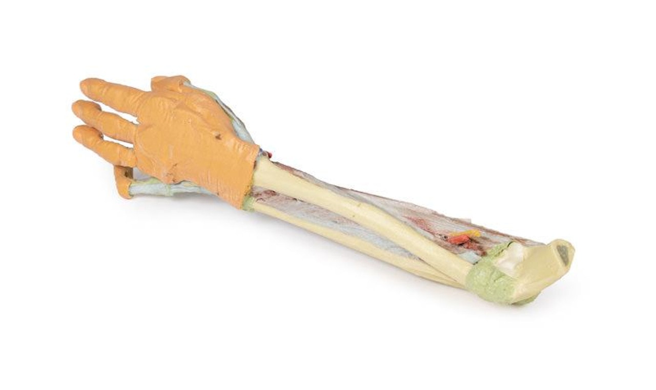 3D printed forearm and hand. Full view. Exposed muscle and bone. Side angle.