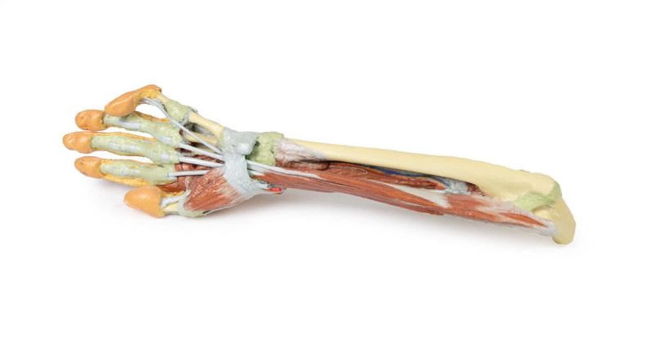 3D printed forearm and hand. Full view. Exposed muscle and bone. Side angle.