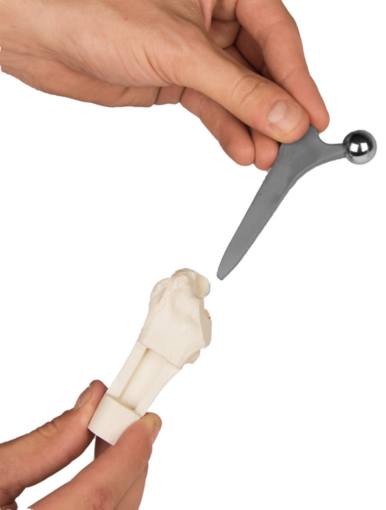 Hip Implant Model