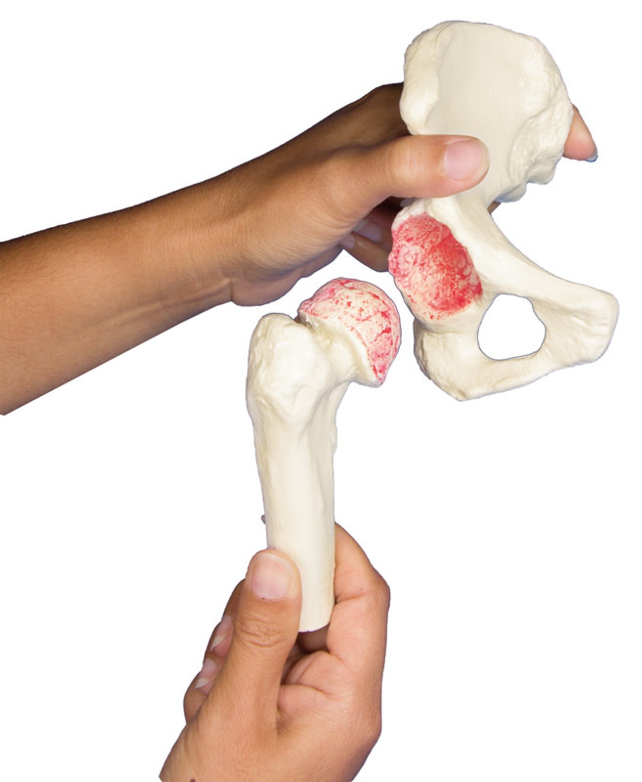 Hip Implant Model