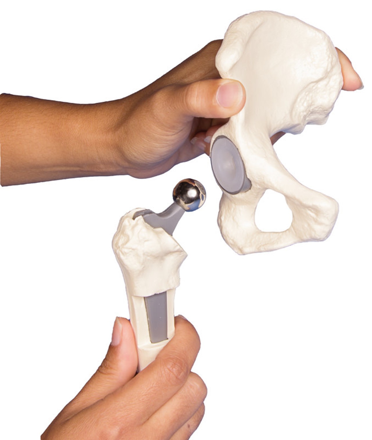 Hip Implant Model