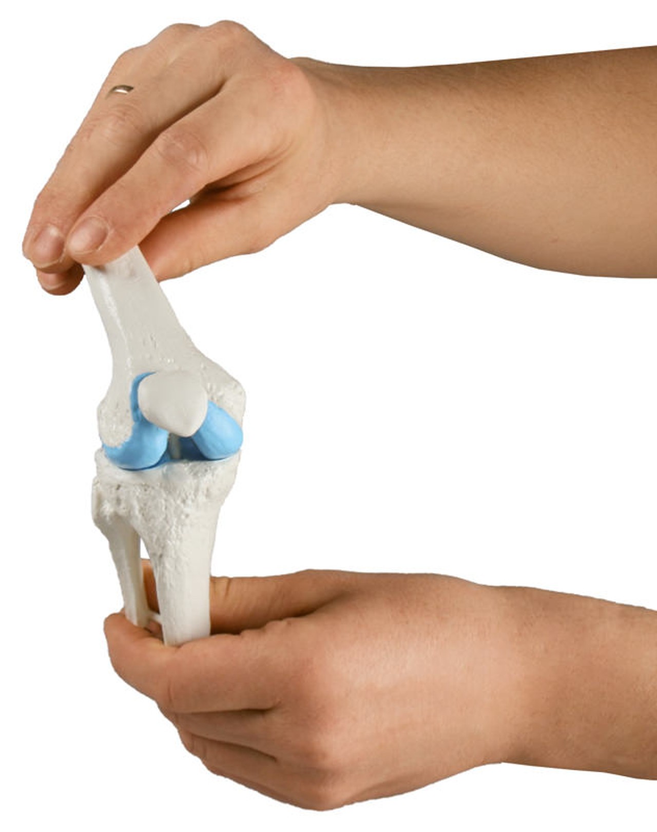 Knee Implant Model