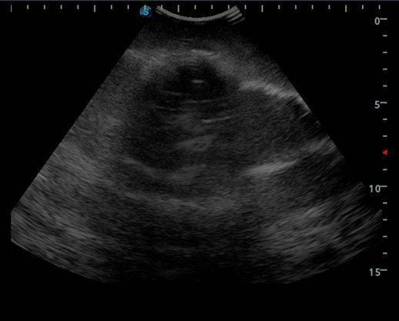 Anatomy Lab Knee Arthrocentesis Ultrasound Training Model