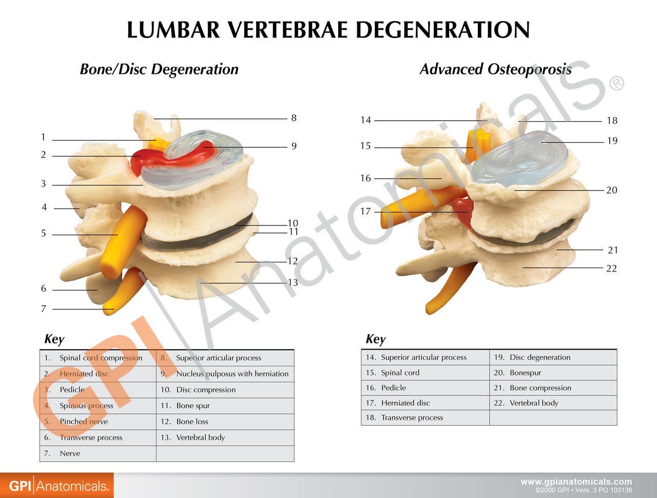 Four Stage Vertebrae Set Anatomy Model