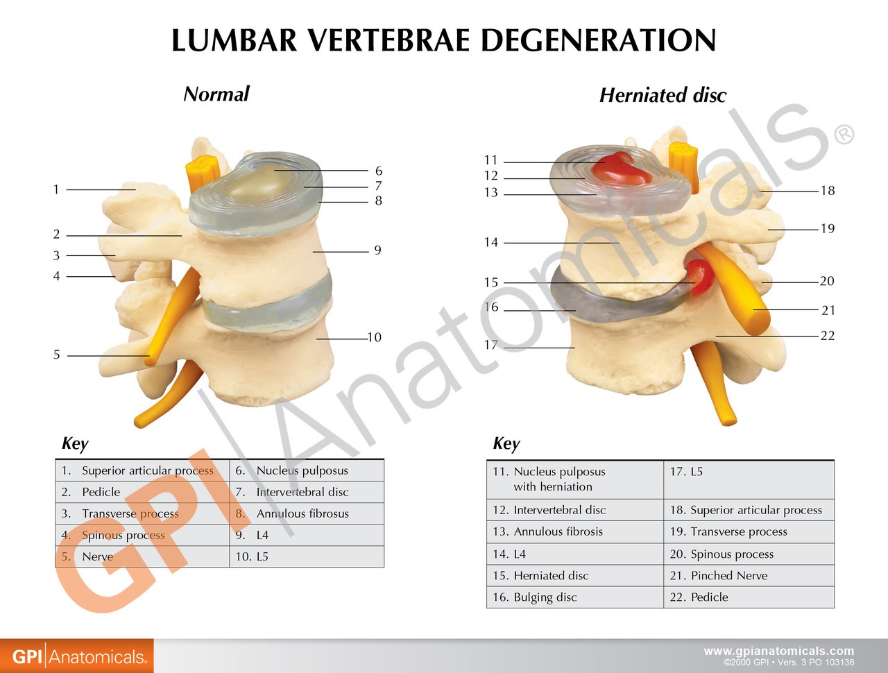 Four Stage Vertebrae Set Anatomy Model