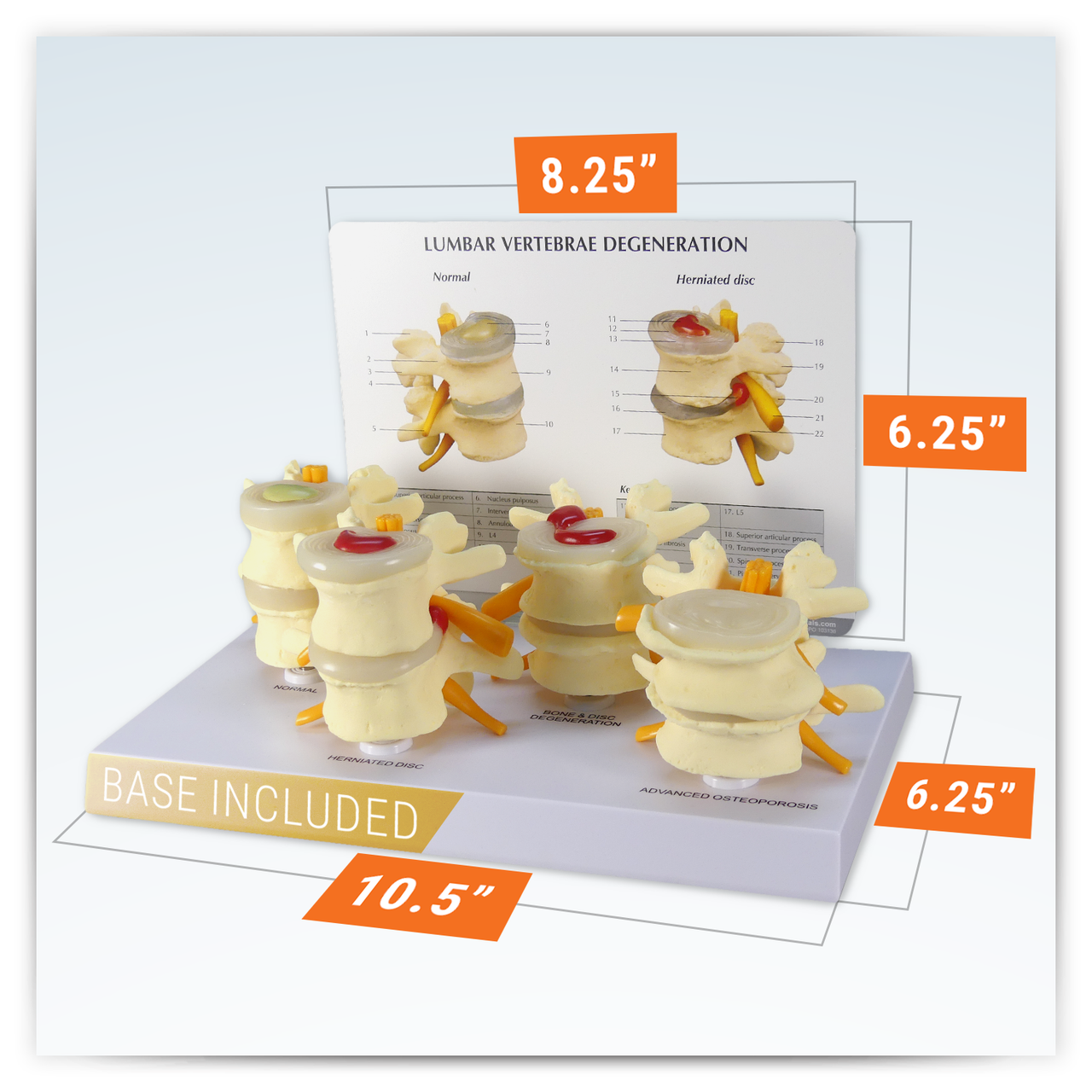 Four Stage Vertebrae Set Anatomy Model