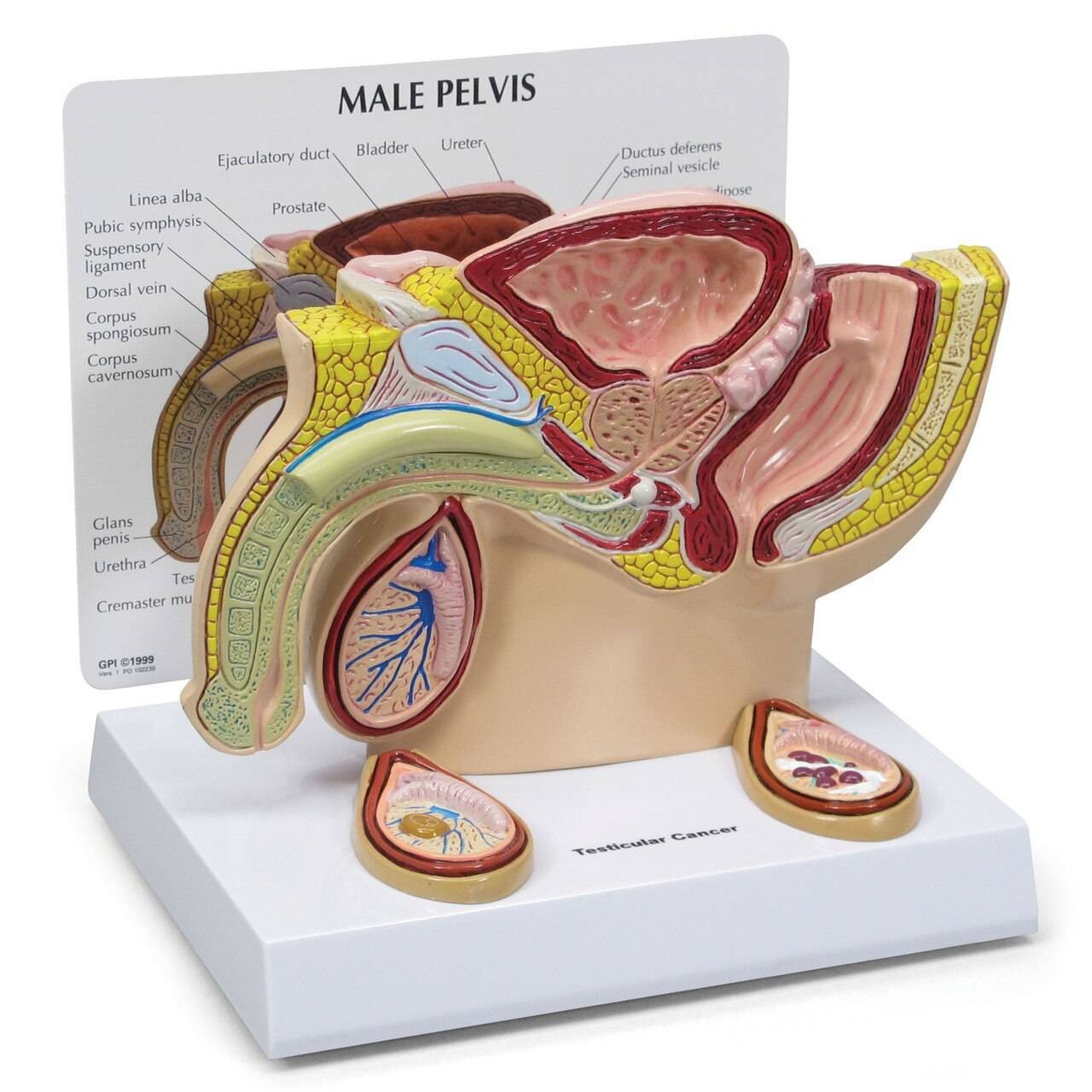 Male Pelvis Anatomy Model With Testicular Cancer