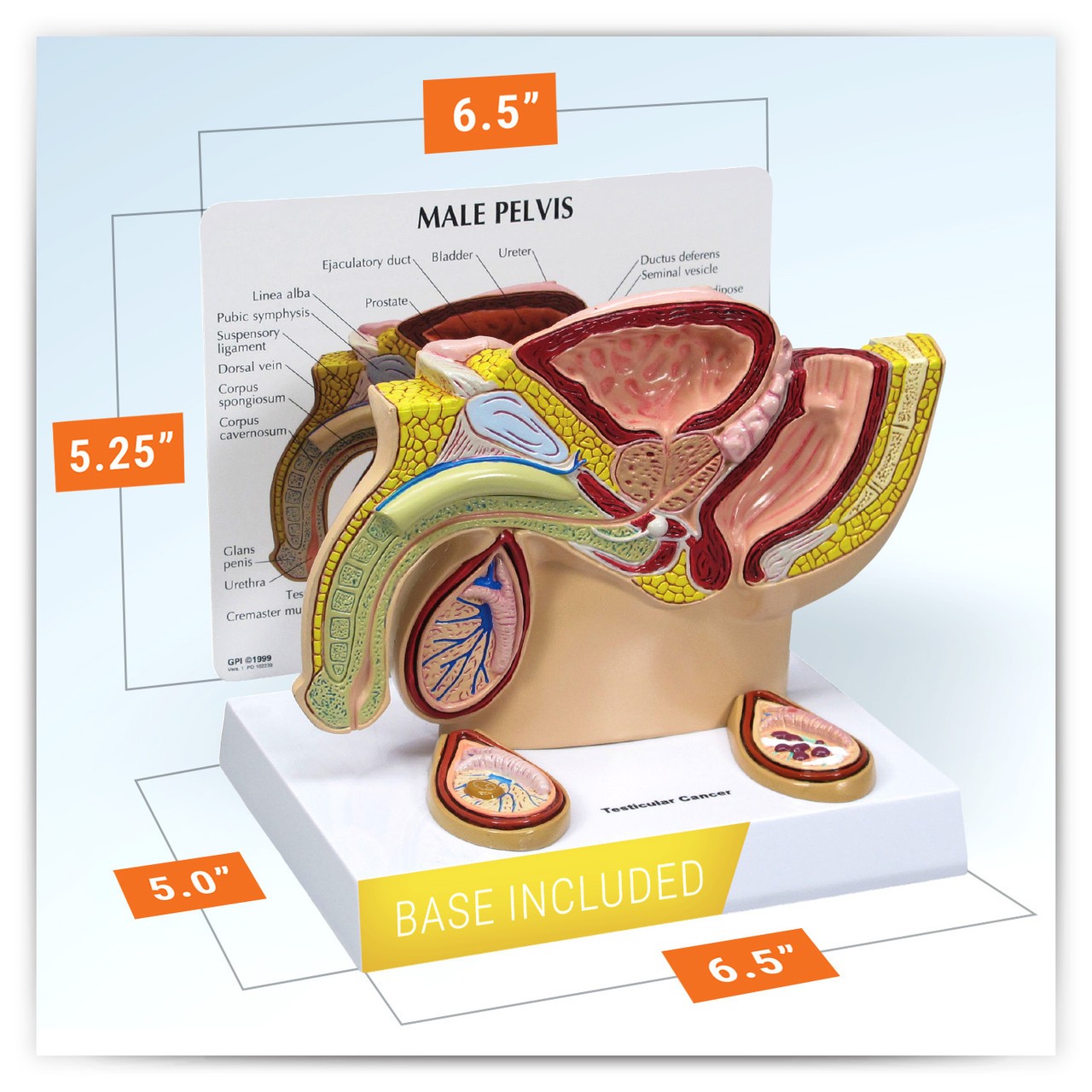 Male Pelvis Anatomy Model With Testicular Cancer