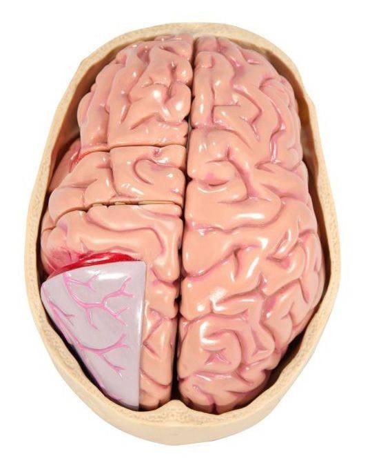 Diseased Brain In Skull Anatomy Model