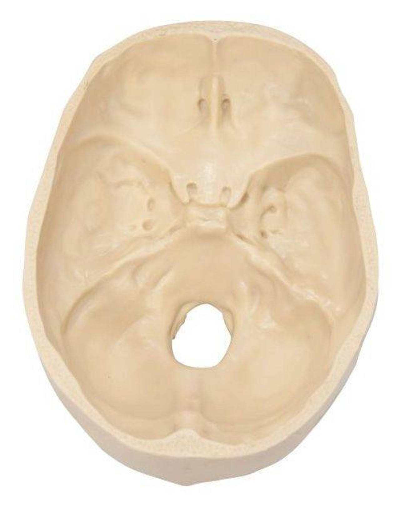 Diseased Brain In Skull Anatomy Model