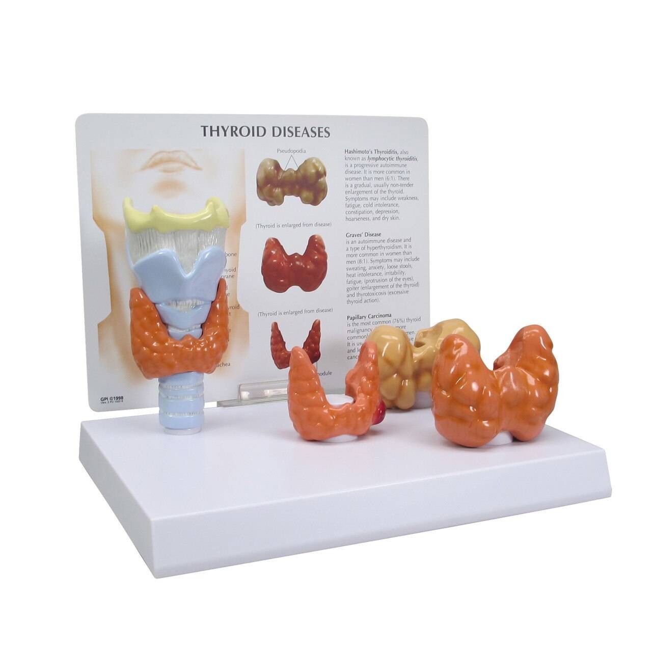 Thyroid Disease Anatomy Model