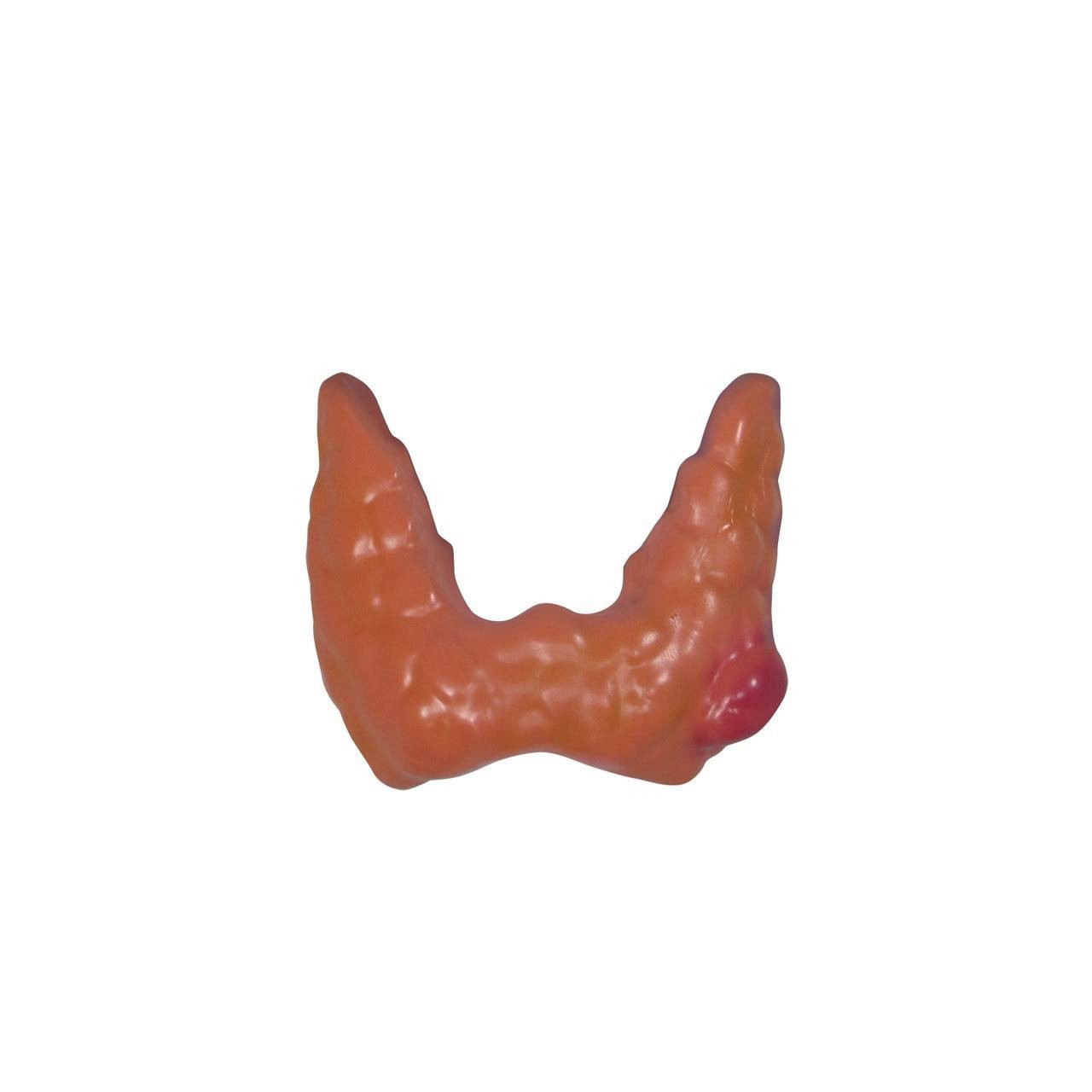 Thyroid Disease Anatomy Model
