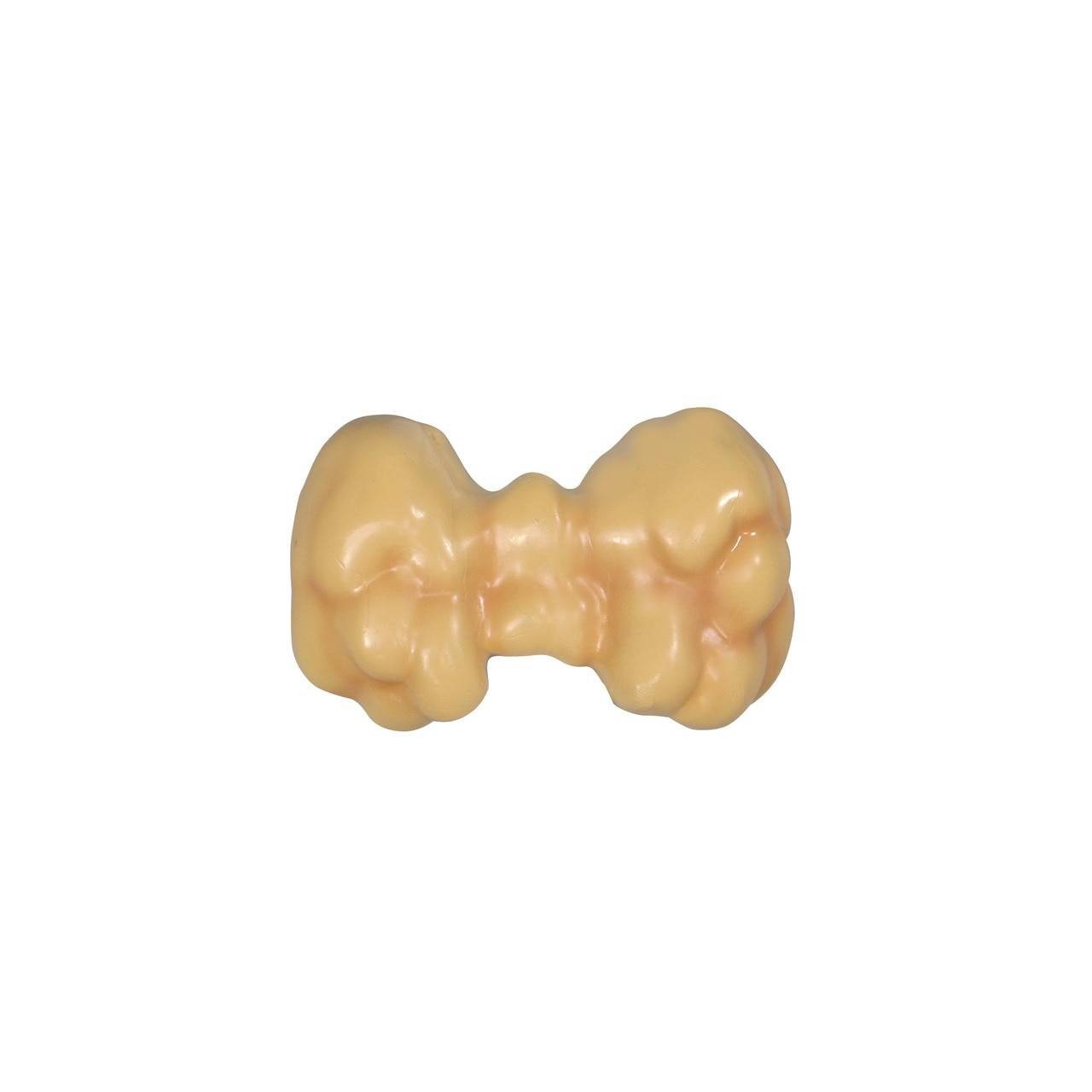 Thyroid Disease Anatomy Model