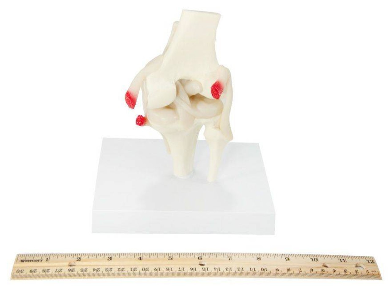 Basic Knee With Key Card Anatomy Model