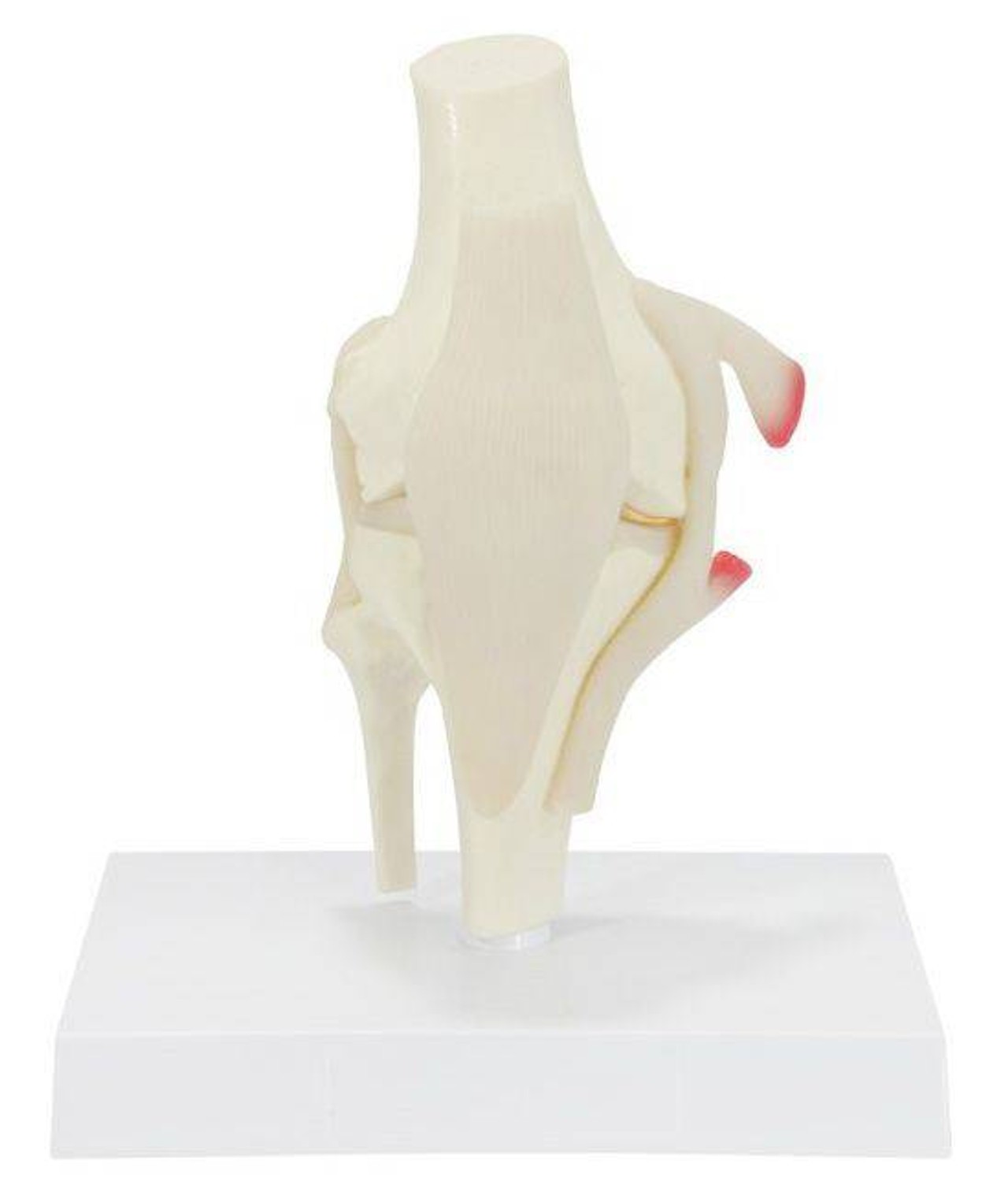 Basic Knee With Key Card Anatomy Model