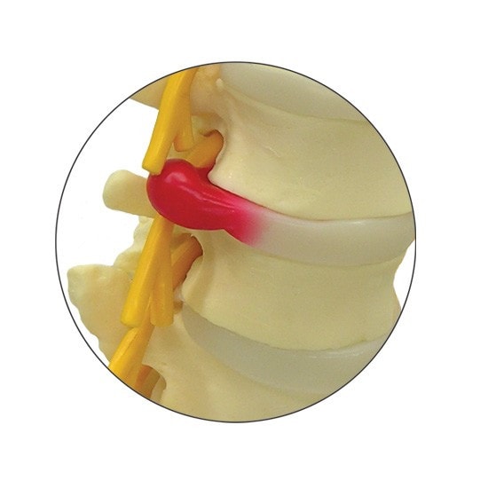 5 Piece Vertebral Column Anatomy Model With Sacrum