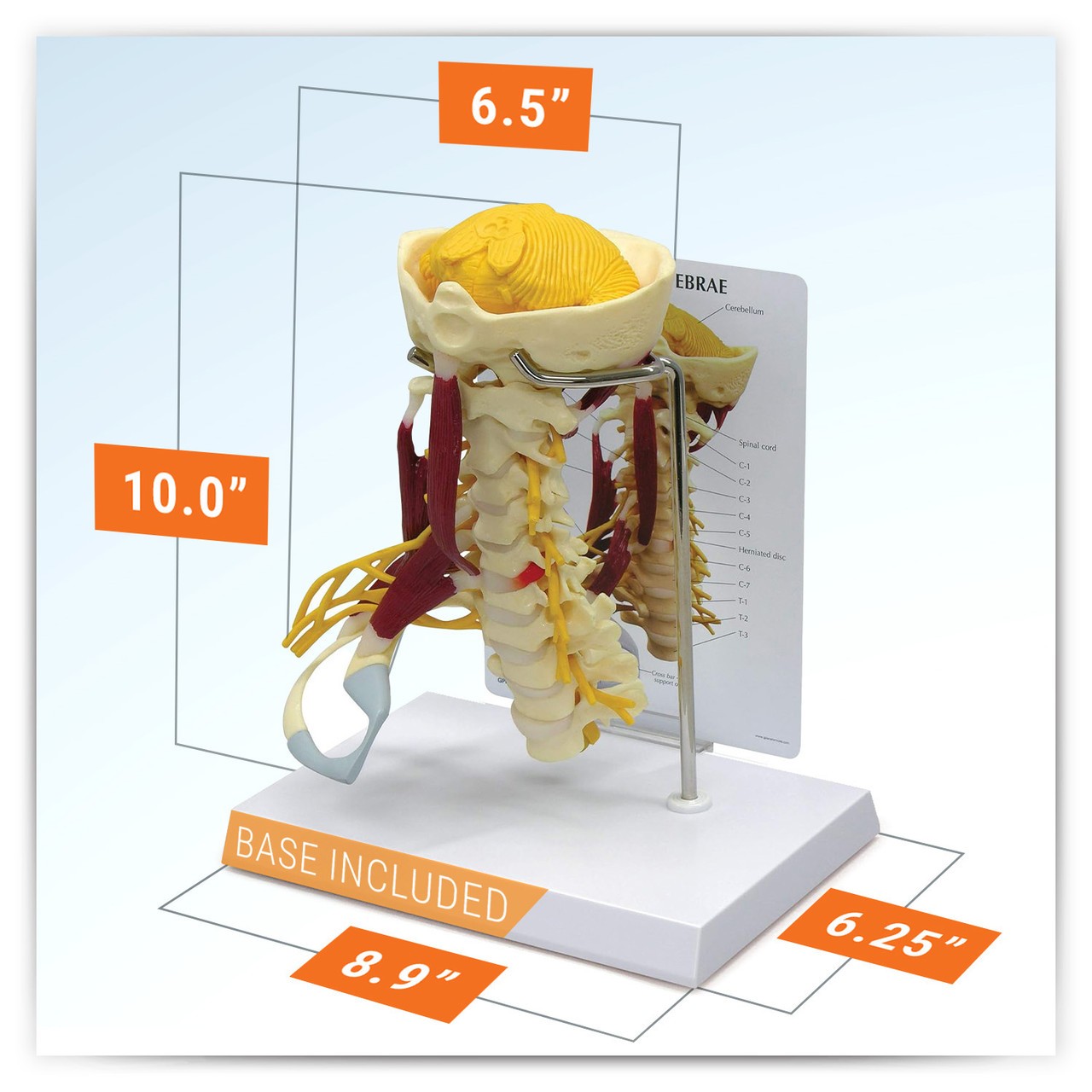 Deluxe Muscled Cervical Anatomy Model