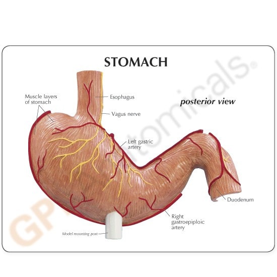 Stomach With Ulcers Anatomy Model
