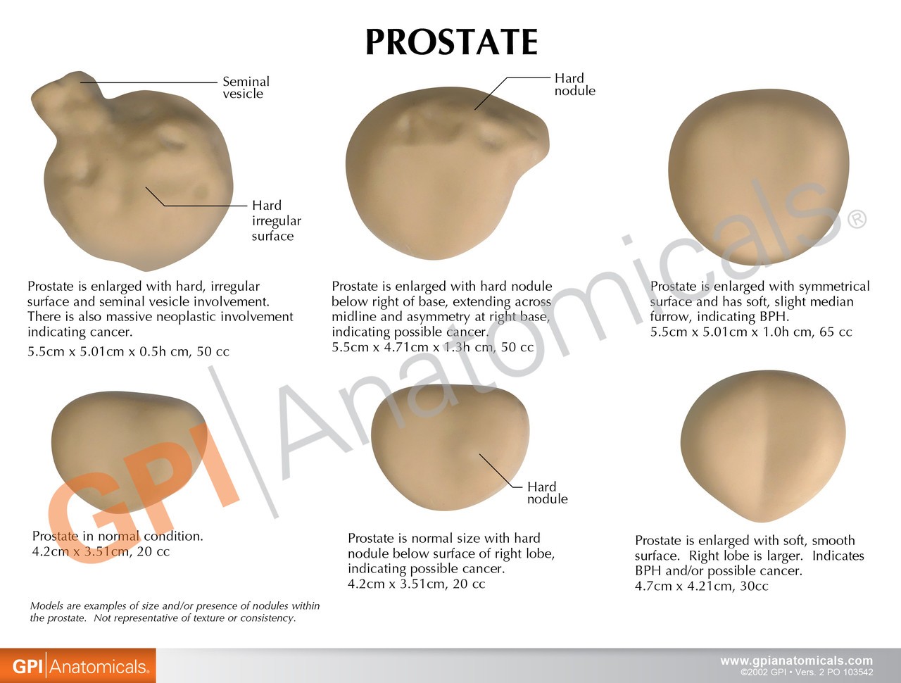 Life-Size Prostate Anatomy Model Set